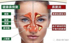 武當派《太和門》秘傳《鼻炎養(yǎng)生導引術